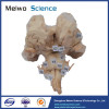 Brain stem plastination specimen with complete nerve root