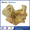 Human trigeminal nerve plastinated specimen