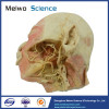 Deep vascular nerve of head and face plastinated specimen