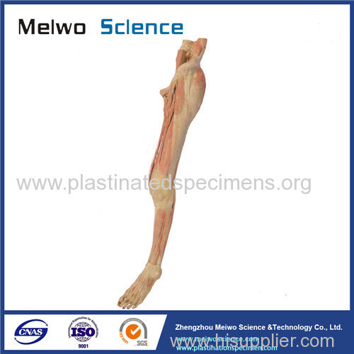 Superficial vein and nerve of lower limb plastinated specimen