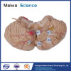 Cerebellar artery plastination specimen