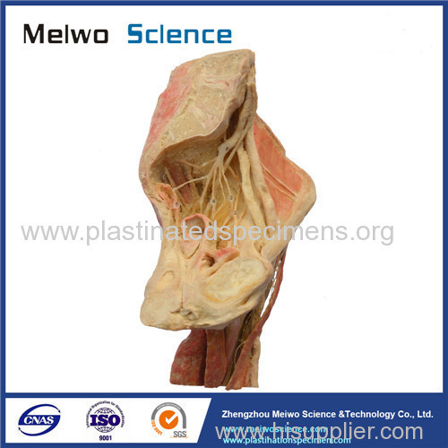 Sagittal section of Female pelvis plastinated specimen