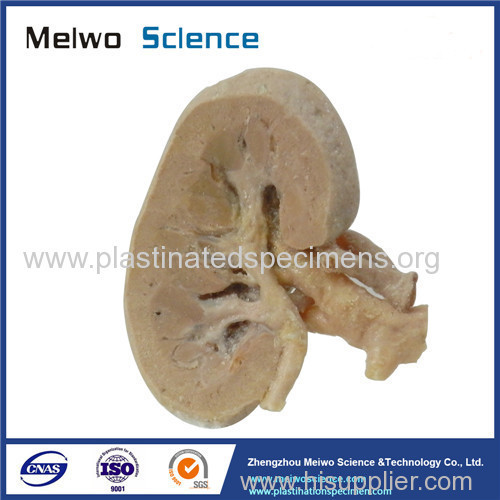 Coronal section of kidney plastinated specimen