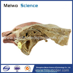 Sagittal section of female pelvis with uterus vessels plastinated specimen
