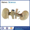 Double kidney plastination specimen for sale