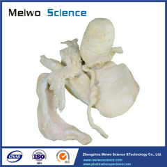Cattle liver biliary pancreas spleen duodenum plastinated specimen