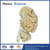 Pig brain hemisphere plastinated specimen