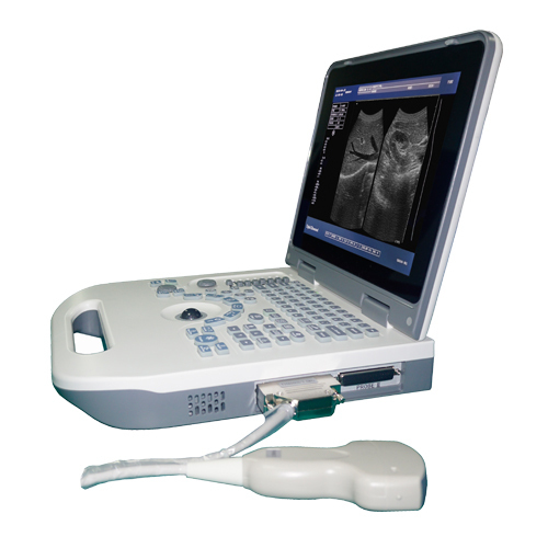 laptop ultrasound diagnostic equipment