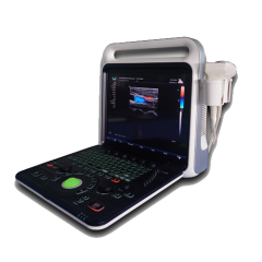 Portable Color Doppler Ultrasound Diagnostic System.15 inch with battery