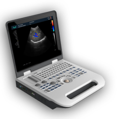 laptop Full Digital Color Doppler Ultrasound Diagnostic Scanner Equipment