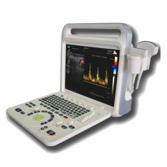 Portable Color Doppler Ultrasound Diagnostic Equipment.15 inch SHARP High Resolution Screen