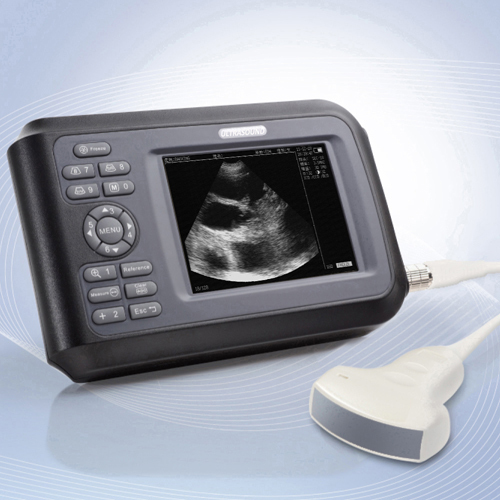 Handheld full digtal black and white ultrasonic scanner