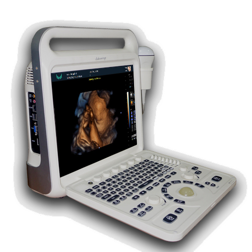 Portable Color Doppler Ultrasound Diagnostic Equipment.15 inch SHARP High Resolution Screen