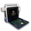 Echowing80 high end color doppler ultrasound diagnostic system