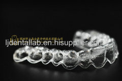 Clear aligners & invisalign teeth aligner & dental brace from LJ Dental Lab China