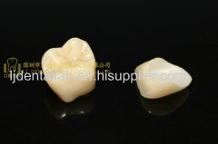 Dental crown zirconia PFZ & dental teeth & dental prosthesis & porcelain fused to zirconia crown