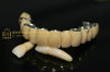 Dental crown composite & dental teeth & Shofu Ceramage dental prosthesis