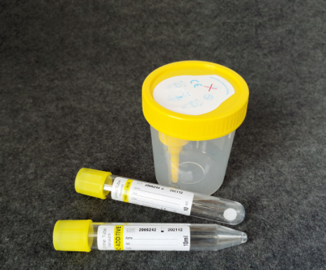 Urinary collection tube and container