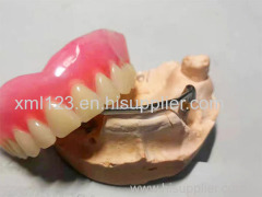 OEM Denture Dental Lab 3D Digital Denture Dental lab Digital Dental Models