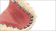 orthodontics,dental,medical products