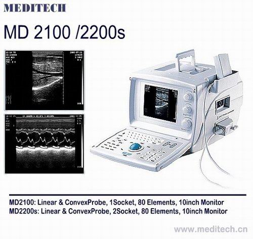 B/W diagnostic Ultrasound Scanner with software