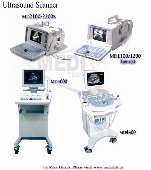 ultrasound scanner